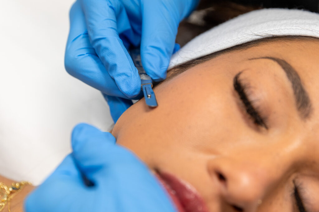 woman gets treatment for dermaplaning in Leawood