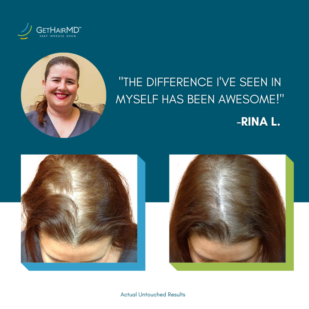 Before and after photos with a quote from patient that says 'The difference I've seen in myself has been awesome.' Photos indicate successful results from DHT blocker in Lawrence